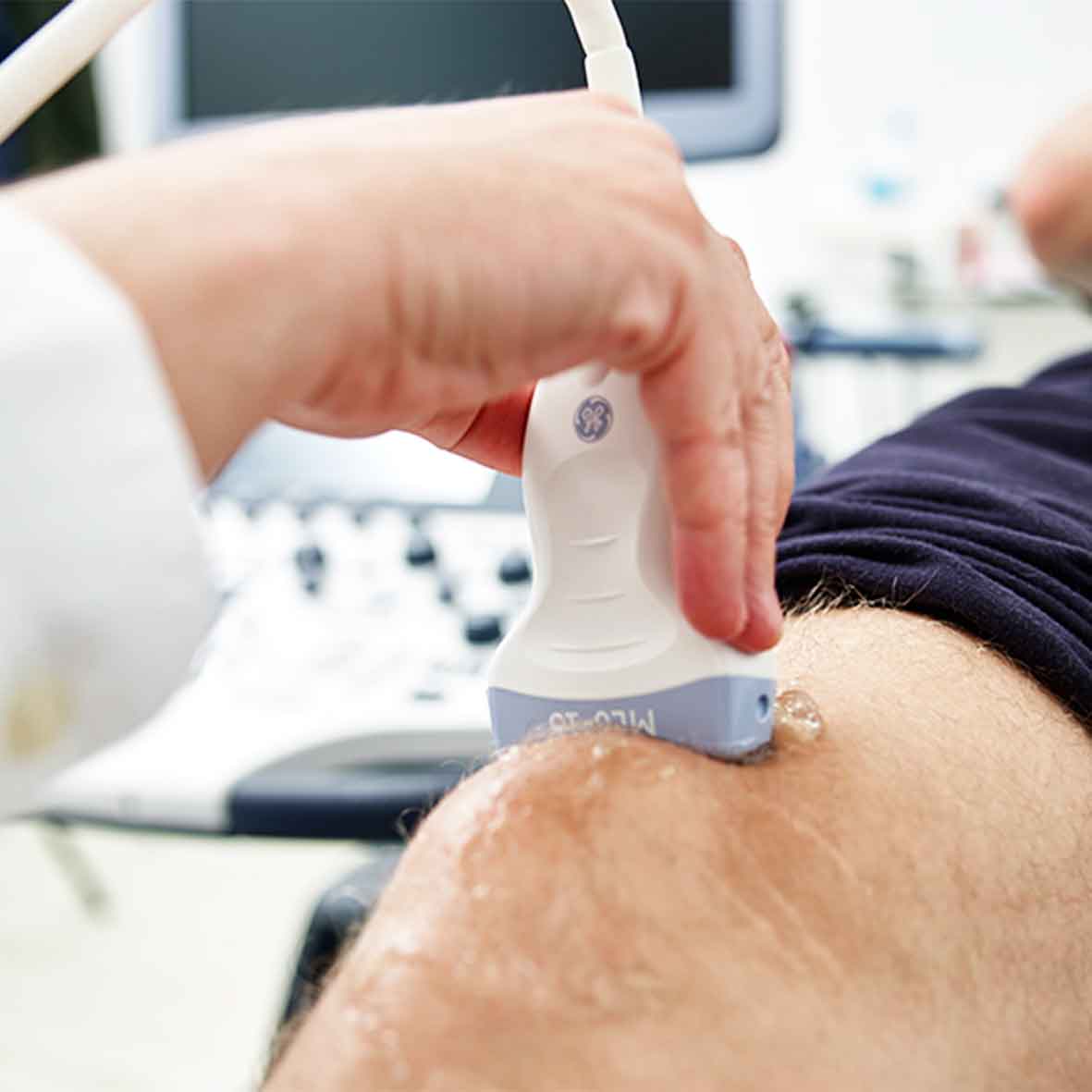 Musculoskeletal ultrasound is an imaging technique that uses ultrasound to visualize muscle tissues, joints and related structures. It is used in physical therapy to diagnose injuries and assess the condition of tissues, which aids in planning effective and personalized treatments.