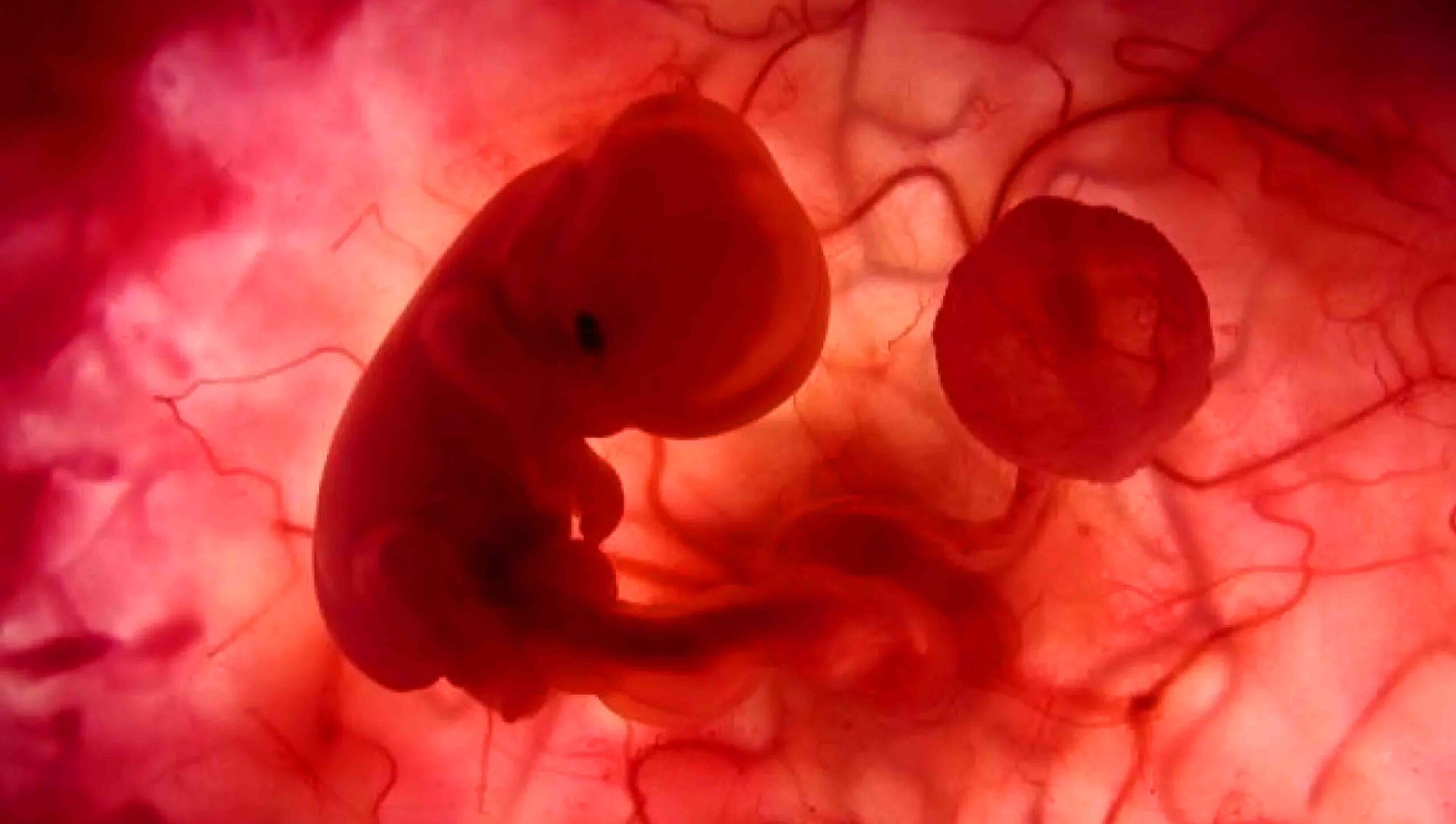 Efectos del ejercicio de un mujer embarazada en el feto blog AMS Centro Médico del Ejercicio
